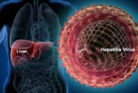 (ilustrasi jenis penyakit Hepatitis, foto: google)