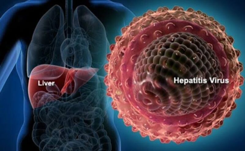 (ilustrasi jenis penyakit Hepatitis, foto: google)